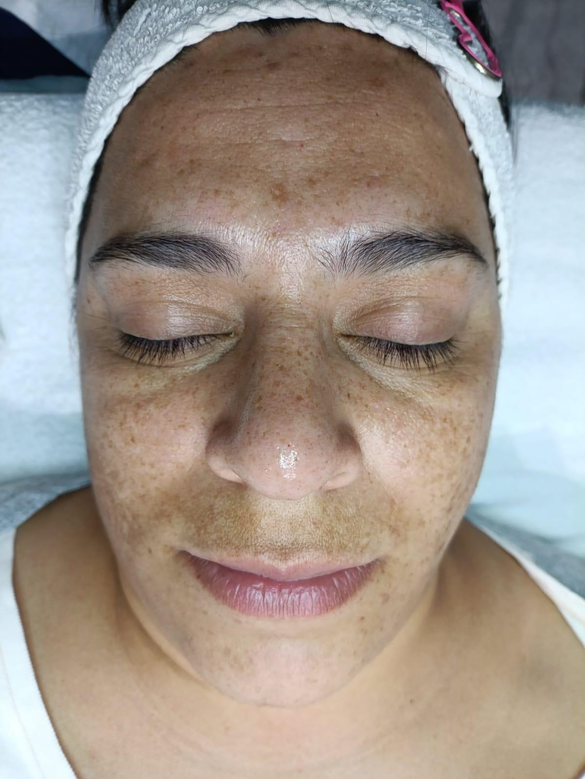 Peeling de algas